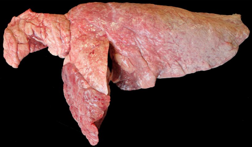 Figure 6. Pig lung co-infected with&nbsp;M. hyopneumoniae&nbsp;and&nbsp;P. multocida. Areas of reddish-brown cranioventral consolidation, elevated with respect to the rest of the lung parenchyma, which would be consistent with a lesion caused by P. multocida. In the cranial lobe and cranioventral margin of the caudal lobe there are reddish depressed areas of consolidation which correspond to lesions caused by M. hyopneumoniae.
